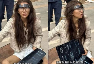 女网红断腿街头流浪 直播揭卖猪仔内幕突遭封禁