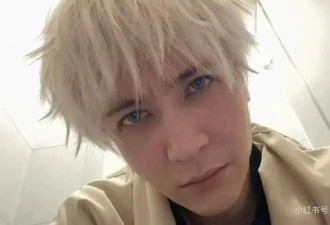 薛之谦晒图自曝“满头斑秃和水泡”！反复漂染发头皮损伤