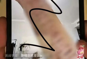 金子涵直播晒求救信和自残照，声称被人下药操控，曾遭圈内潜规则