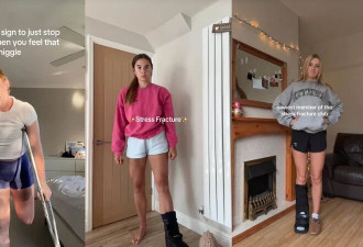 热爱健康的白女 掀起人类史上第一个骨折潮
