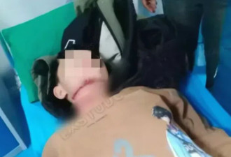 13岁男孩被老人拉绳锁喉，已赴京治疗脱离危险