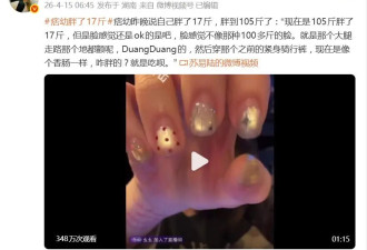网红痞幼自曝做了“妈妈臀”吸脂手术，“四个屁股”影响上镜效果，术后体重增加
