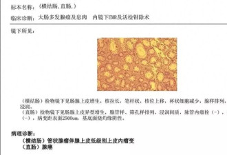 没有便血，39岁确诊直肠癌