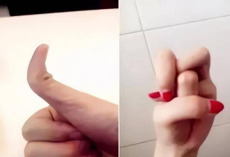 10种罕见的人体特征，拥有一个或是“天选之人”