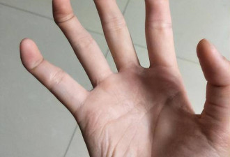 10种罕见的人体特征，拥有一个或是“天选之人”
