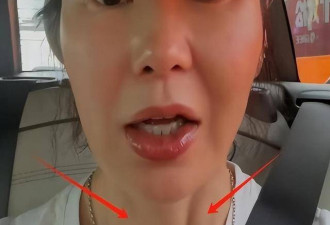 张曼玉现身北京参加活动！脸僵肿到不敢认