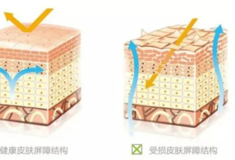 硫磺皂 是皮肤“神器”还是“杀手”？