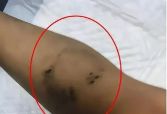 上海3岁男童遭生父女友虐死体无完肤 凶手判死缓