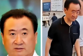 王思聪大变样!暴瘦脱相还秃顶,父亲王健林自身...