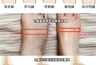 五六十岁女人 鞋子尽量少穿运动鞋、小白鞋