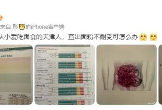 毛晓彤回应去医美诊所：从小爱吃面食，查出面粉不耐受可怎么办