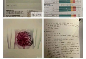 毛晓彤深夜被拍疑医美，当晚晒报告自证清白！