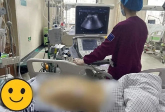 桂林夫妻在楼道养鸡双双住进ICU 医生揪出元凶