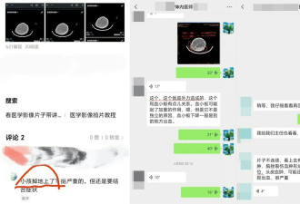 男童脑瘫治疗7年 家长翻病历质疑医院有所隐瞒…