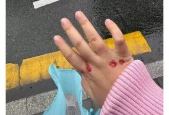 深圳女子公交站制止吸烟 竟被带到派出所“裸检”