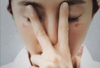 杨幂脸被蒸汽眼罩烫伤了！脸部受伤的明星还有谁？