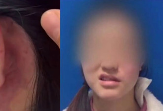 中国4.8亿人疯看“精灵耳整形” 竟藏大危机