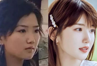 毛晓彤否认医美:对比7位"当红花"的出道照一目了然