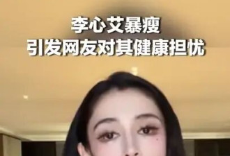 女演员李心艾暴瘦80斤 引发网友对其健康担忧