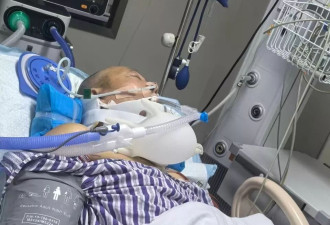 他健身时锁扣断裂被弹飞致下肢瘫痪，健身房称监控损坏
