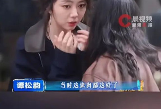 谭松韵拍戏受伤不敢告诉家人：当时感觉这是我这辈子受过最严重的伤了