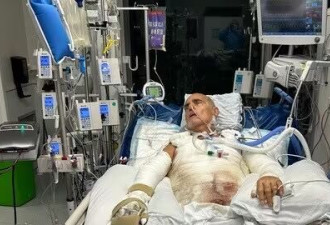 加拿大法拉利门店突然爆炸！男子56%烧伤，怒告索赔2080万