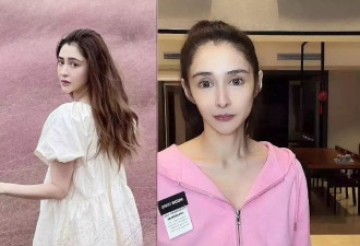 知名女演员4个月暴瘦80斤，直播画面让人头皮发麻