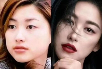多次入选最美100张面孔的朱珠，多次整容面容曝光
