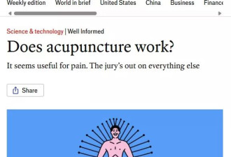 经济学人：针灸为什么有用？
