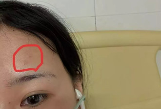取亚硒酸“中毒”之后：劳动者的职业病鉴定死胡同
