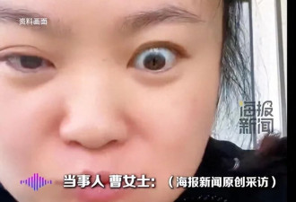 女子一吃东西就“大小眼” 称嘴眼有一个神经串联