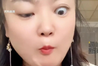 女子一吃东西就“大小眼” 称嘴眼有一个神经串联