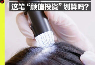 二三十岁女性为何争相“种发际线”？