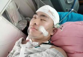 研究生被16岁少年驾车撞致颅脑损伤 如今心智如幼童