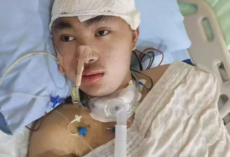 23岁研究生被少年无证驾车撞成重伤后心智如幼童