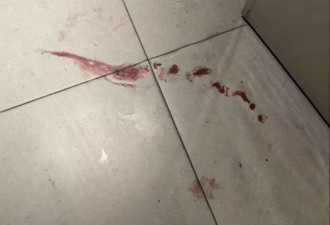 女子提醒邻居别在家门口放垃圾 被对方破门殴打