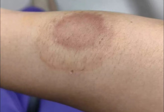 女子提醒邻居别在家门口放垃圾 被对方破门殴打
