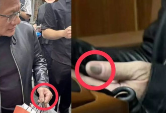 黄仁勋“灰色指甲”引百万人关注 皮肤科医生这样解读
