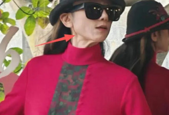 67岁杨丽萍终究还是服老，拄双拐剪指甲，墨镜遮挡不住皱纹
