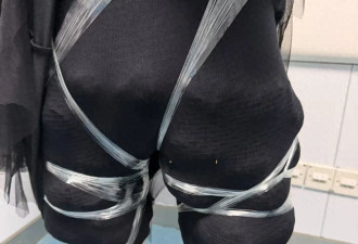 女子身上有腥臭味 海关拦截检查