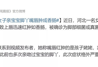 宝宝有脚气！外婆不听劝亲小脚 嘴唇感染肿成香肠
