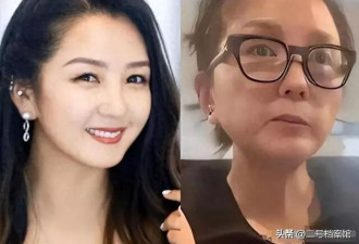 女星丢掉滤镜后，刘亦菲牙黄、杨幂瞬间老十岁