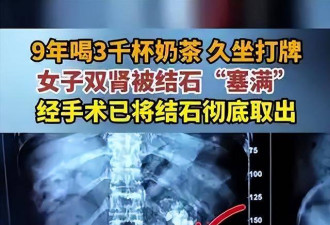 长沙女子9年狂喝3000杯奶茶，悲剧发生了