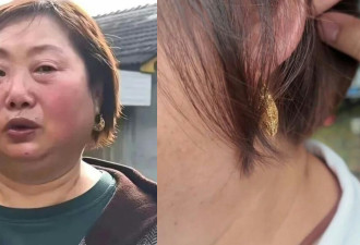 湖南救灾女干部因戴金耳环遭网暴 官媒出场