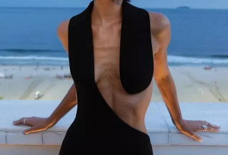 巴西女模暴瘦至胸骨醒目，引发争议后打破沉默