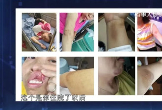 53岁女子忍受10年家暴拍下132张伤情照，法院判了
