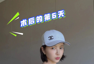 杜淳老婆王灿发文报平安！称自己做完切肺手术后已出院