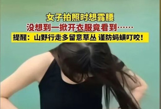 吓人! 女子景区拍照 低头发现蚂蟥正往肚脐里钻