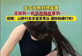 吓人! 女子景区拍照 低头发现蚂蟥正往肚脐里钻