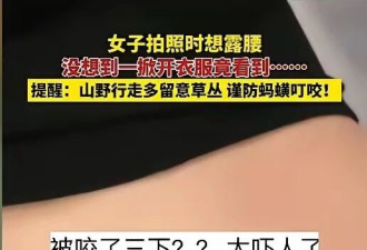 吓人! 女子景区拍照 低头发现蚂蟥正往肚脐里钻